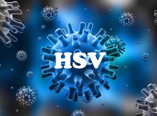 Virus HSV